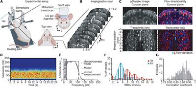 Quantitative Hemodynamic Measurements in Cortical Vessels Using Functional Ultrasound Imaging